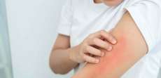Dermatologist Near McLean, Virginia for Sudden Skin Allergic Reaction or Hives