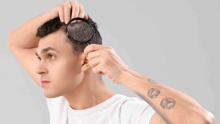 Dermatologist Near Vienna, Virginia for Severe Dandruff or Scalp Dermatitis