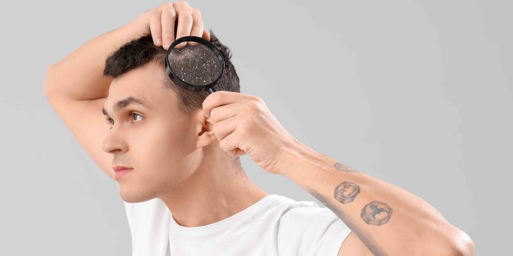 Dermatologist Near Vienna, Virginia for Severe Dandruff or Scalp Dermatitis