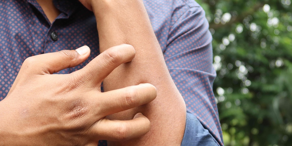 Dermatologist Near McLean, Virginia for Skin Infection or Spreading Red Patch