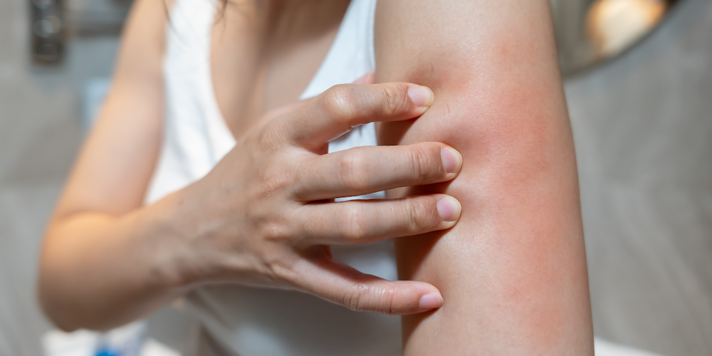 Dermatology Appointment for Circular Rash or Possible Ringworm in Falls Church, Virginia