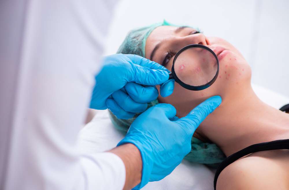 Acne Dermatologist Appointment Near Alexandria, Virginia with Same Week Availability