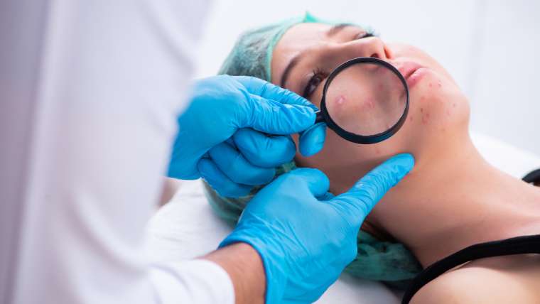 Acne Dermatologist Appointment Near Alexandria, Virginia with Same Week Availability