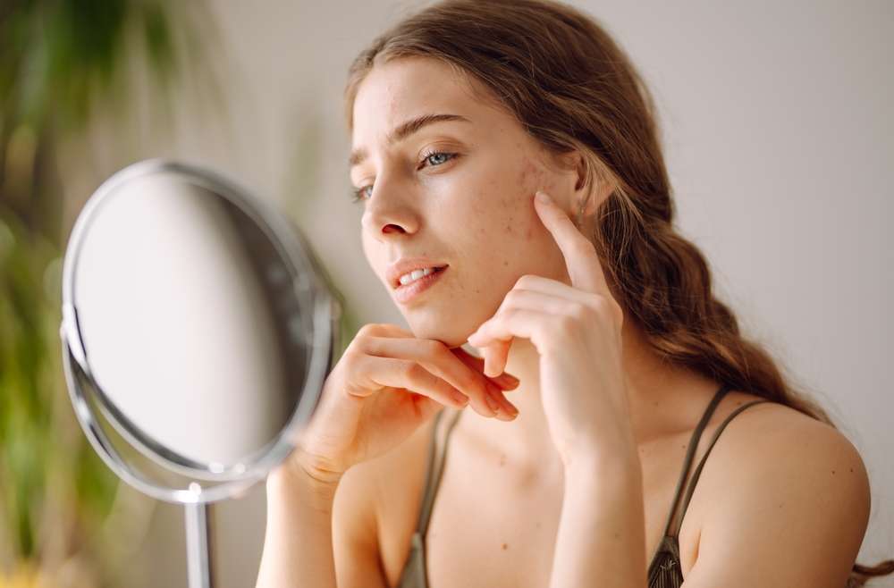 Dark Spots Treatment Near Vienna, Virginia, Dermatologist For Pigmentation