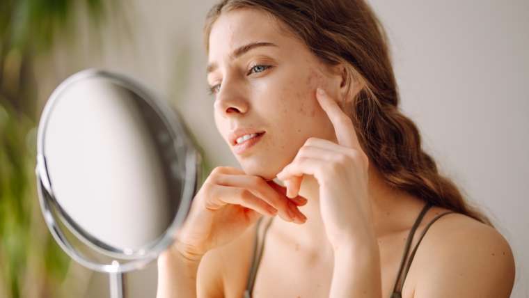 Dark Spots Treatment Near Vienna, Virginia, Dermatologist For Pigmentation