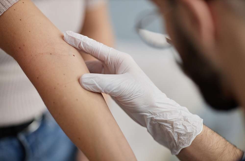 Itchy Skin Dermatologist Near McLean, Virginia: Causes And Treatment