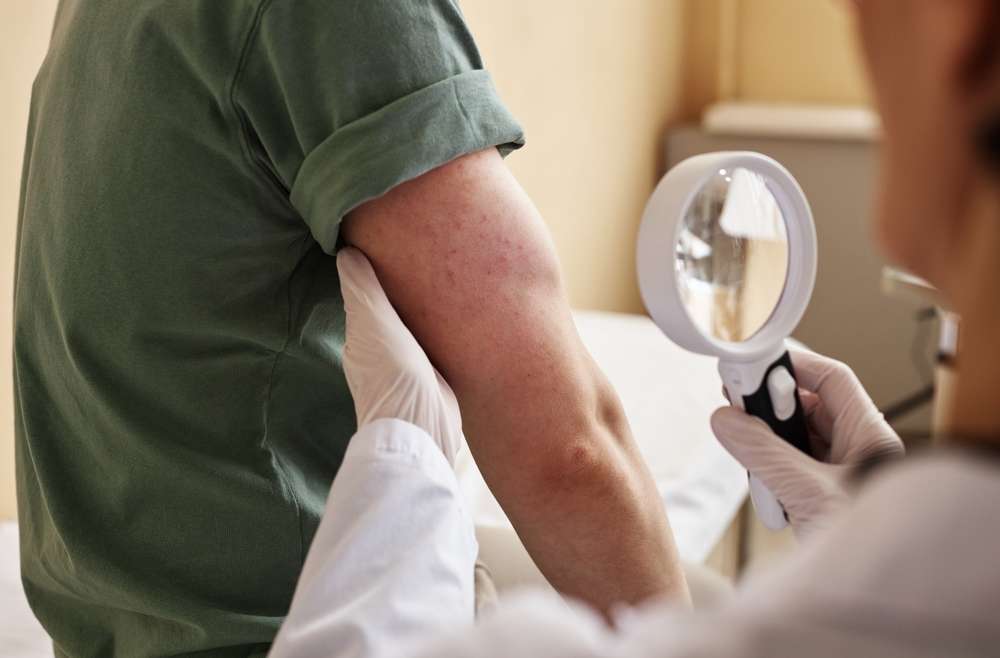 Psoriasis Specialist Near Falls Church, Virginia: Best Treatment Options