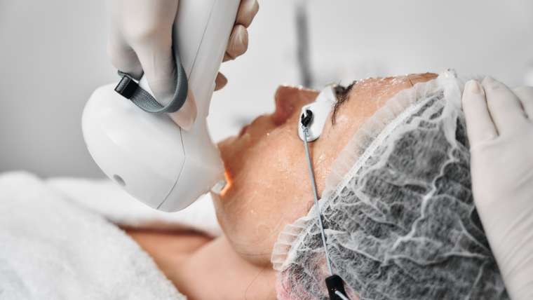 Rosacea Treatment Near Alexandria, Virginia: Redness And Flushing Help