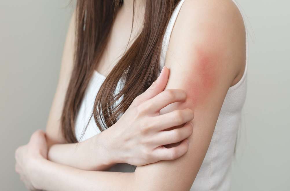 Urgent Dermatology Visit: Skin Rash Treatment Near Vienna, Virginia
