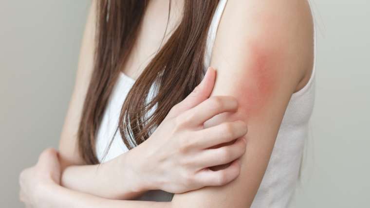 Urgent Dermatology Visit: Skin Rash Treatment Near Vienna, Virginia