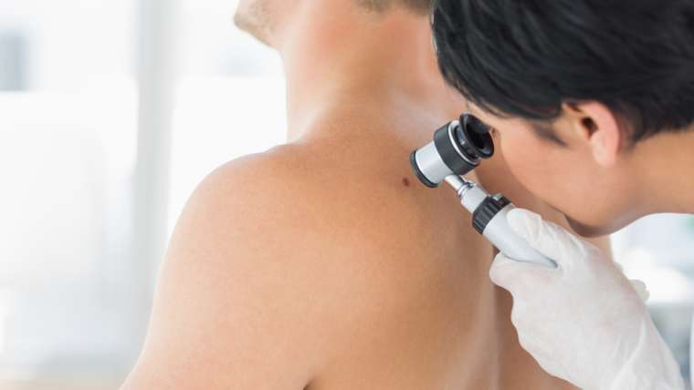 Annual Skin Cancer Checks Near Merrifield, VA: Why Preventive Dermatology Matters
