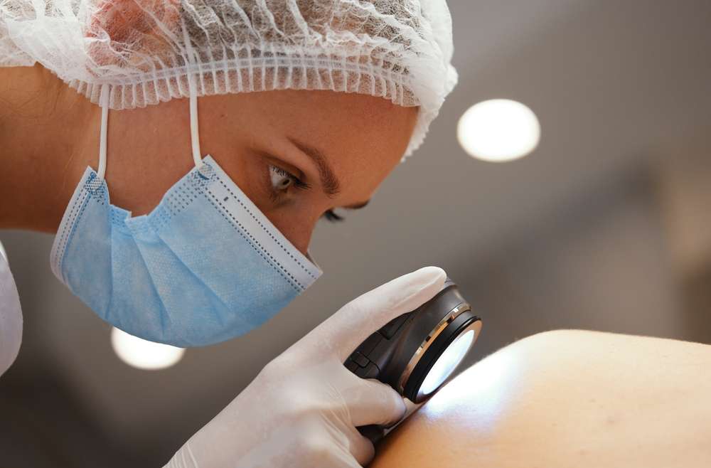 When Should You Worry About a Mole? Skin Cancer Screening Recommendations for Arlington, VA Residents