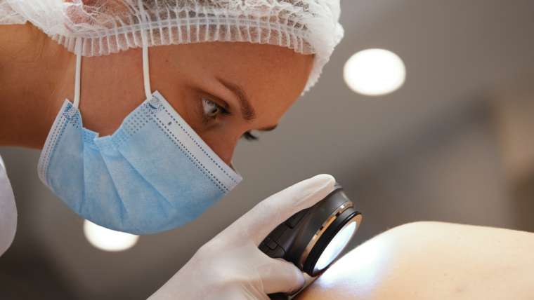When Should You Worry About a Mole? Skin Cancer Screening Recommendations for Arlington, VA Residents