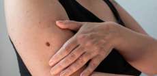 Warning Signs of Skin Cancer Near Falls Church, VA: When a Spot Should Be Evaluated by a Dermatologist