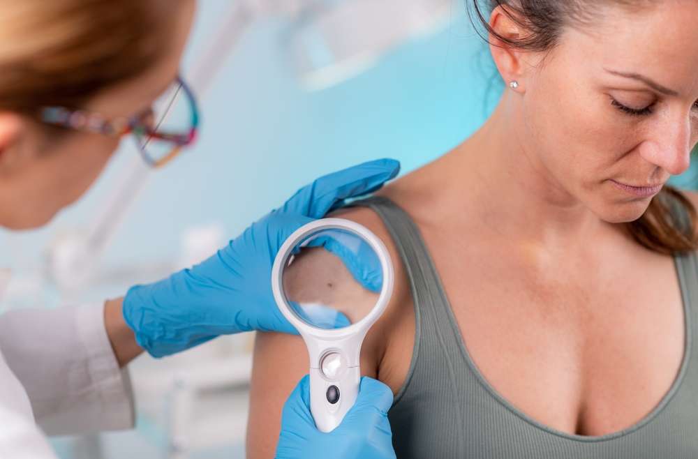 Are You More or Less Likely to Get Skin Cancer a Second Time?