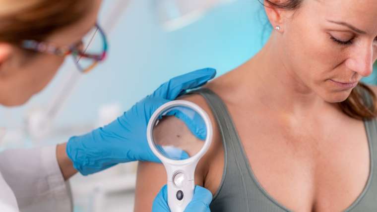 Are You More or Less Likely to Get Skin Cancer a Second Time?