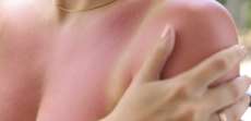 Does Fair Skin That Burns Easily Actually Raise Your Skin Cancer Risk?