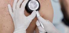 What Makes Melanoma Different from Other Skin Cancers in Vienna, VA